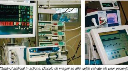 Problemele respiratorii, rezolvate de plămânul artificial din Timişoara