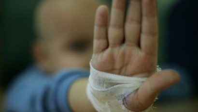 Numărul copiilor bolnavi de cancer este în creştere în regiunea de vest a ţării!