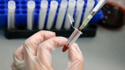 A fost lansat un vast studiu asupra consecințelor infecției cu virusul Zika