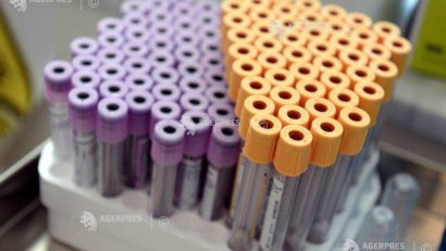 Sacrificiul cadrelor medicale de la Spitalul de Boli Infecţioase Timişoara, în lupta cu COVID-19 ajunge uneori, până la epuizare! O singură persoană prelucrează testele venite de la pacienţii suspecţi de coronavirus