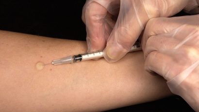 Vaccinarea împotriva difteriei şi a tetanosului recomandată adulţilor odată la 10 ani