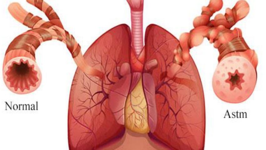 Spirometrii gratuite în weekend la Timişoara